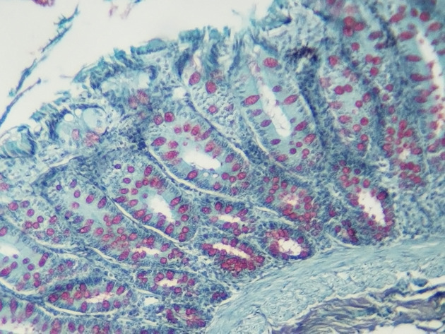 Simple Columnar Epithelium Slides - Simple Columnar Epithelium 07 100X